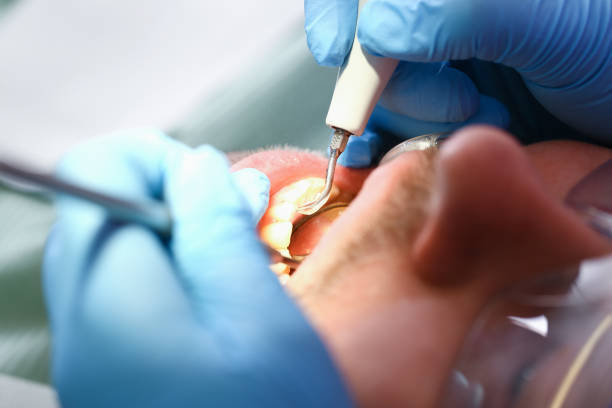 Best Broken or Cracked Tooth Emergency Dentist in Graceville, FL