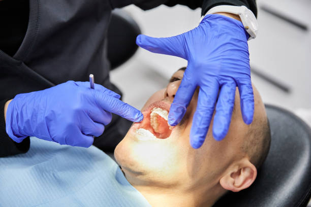 Best Emergency Dentist for Lost Fillings or Crowns in Graceville, FL